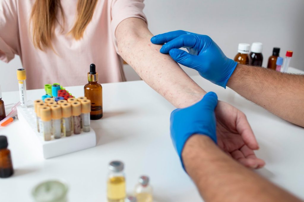 Have Allergies? My Allergy Shot Experience